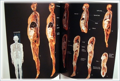 bodyWorlds_slices.JPG